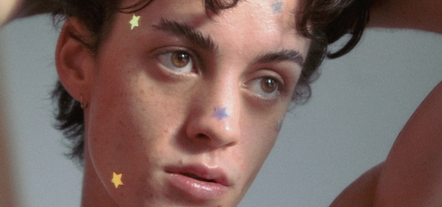 Holographic Star Pimple Patches on boys face healing pimples, zits and whiteheads